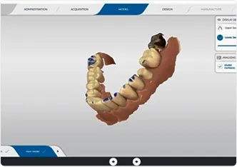 CEREC Software <br>  Intuitive & Smart